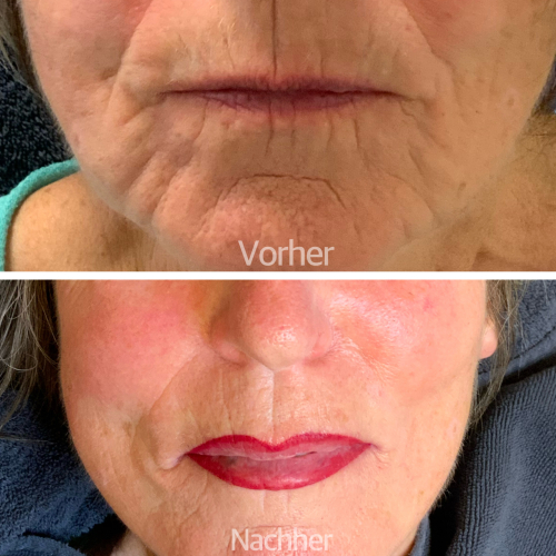 Referenz 5 Referenz 5