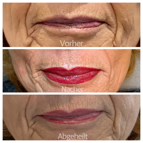 Referenz 9 Referenz 9